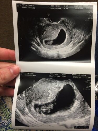 Pregnancy Announcement Ultrasound Week 8